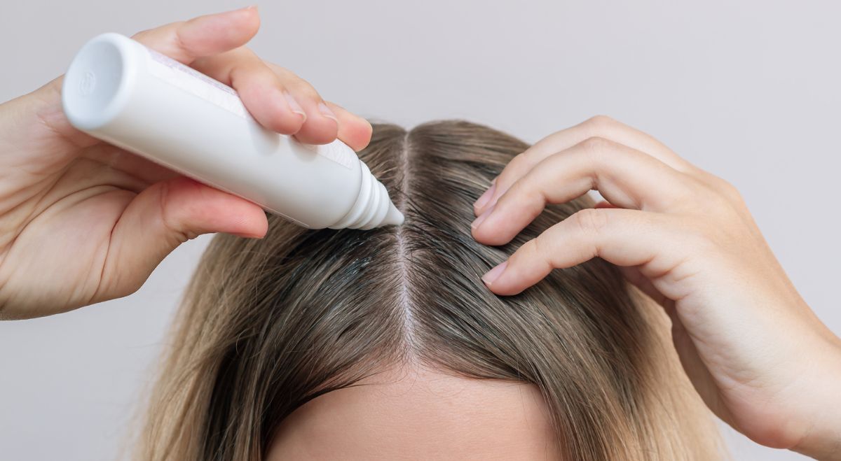 RsBE-03-2025_Scalp-Care.jpg