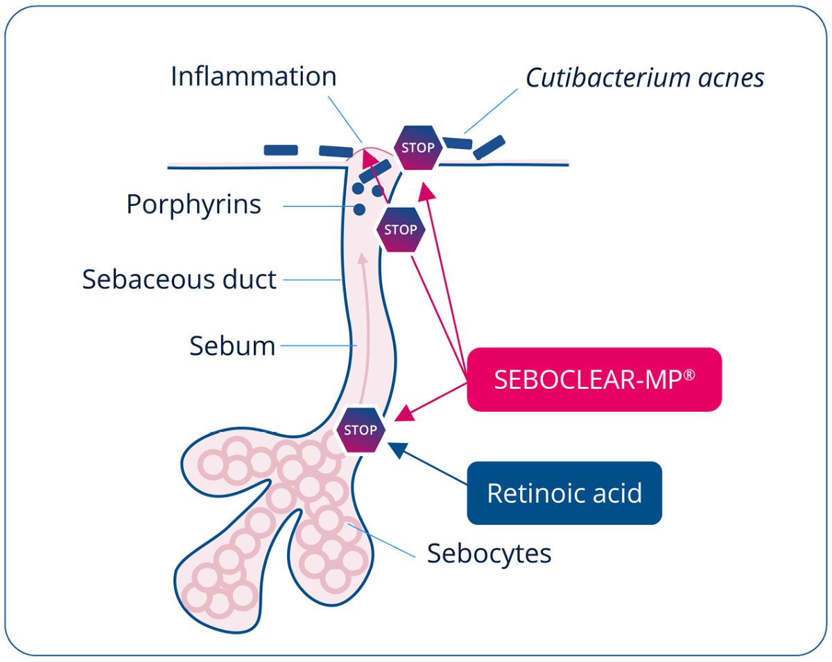 01_SEBOCLEAR-MP_Retinol-alternative.jpg